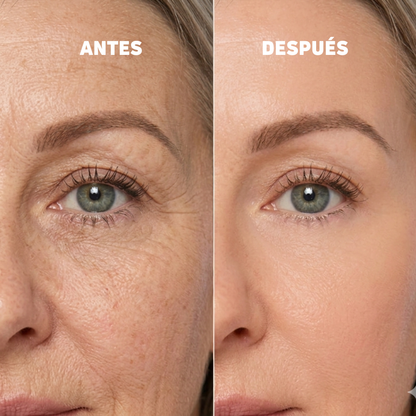 Baume au Calcium | Élu Meilleur Produit Beauté d'Europe