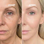 Baume au Calcium | Élu Meilleur Produit Beauté d'Europe