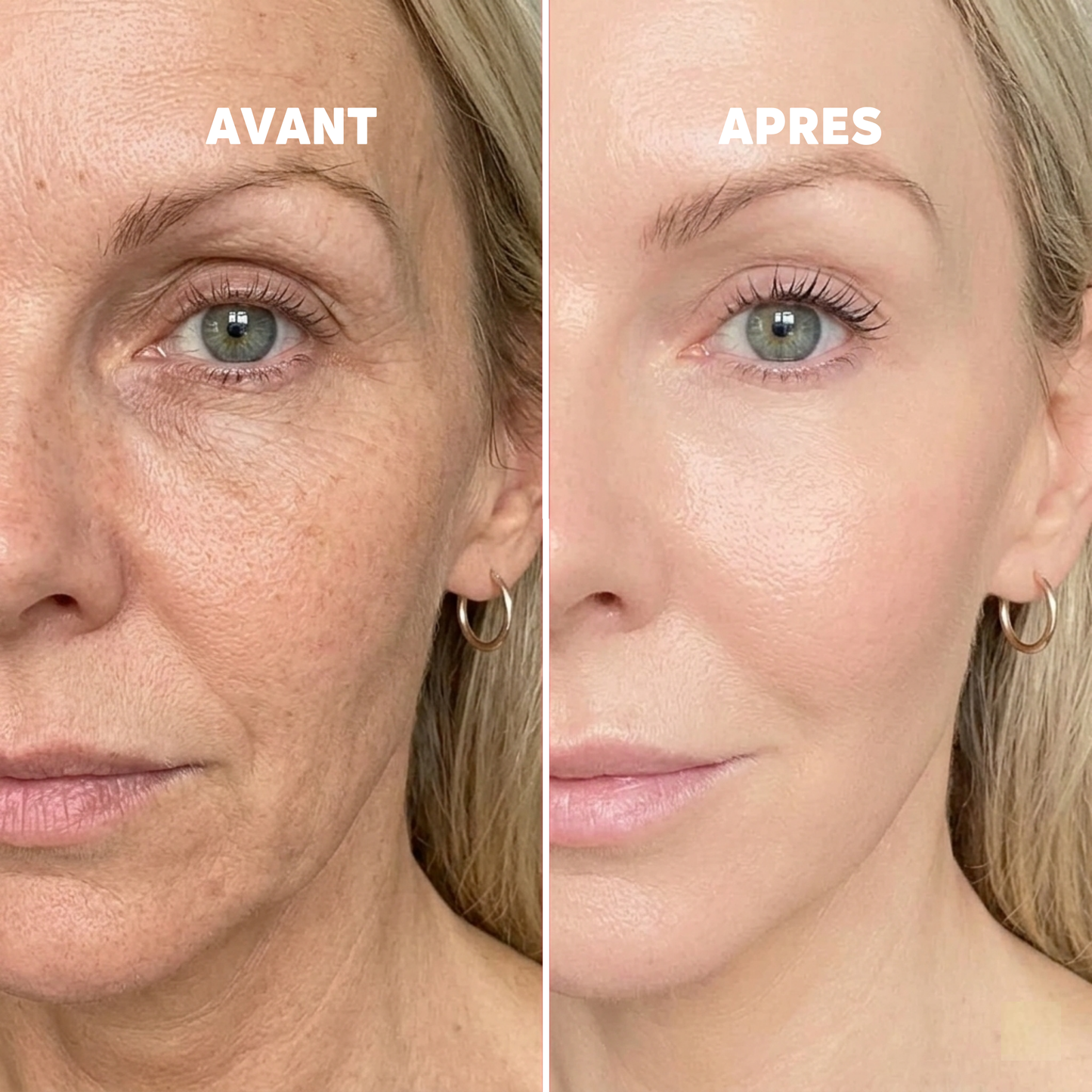 Baume au Calcium | Élu Meilleur Produit Beauté d'Europe