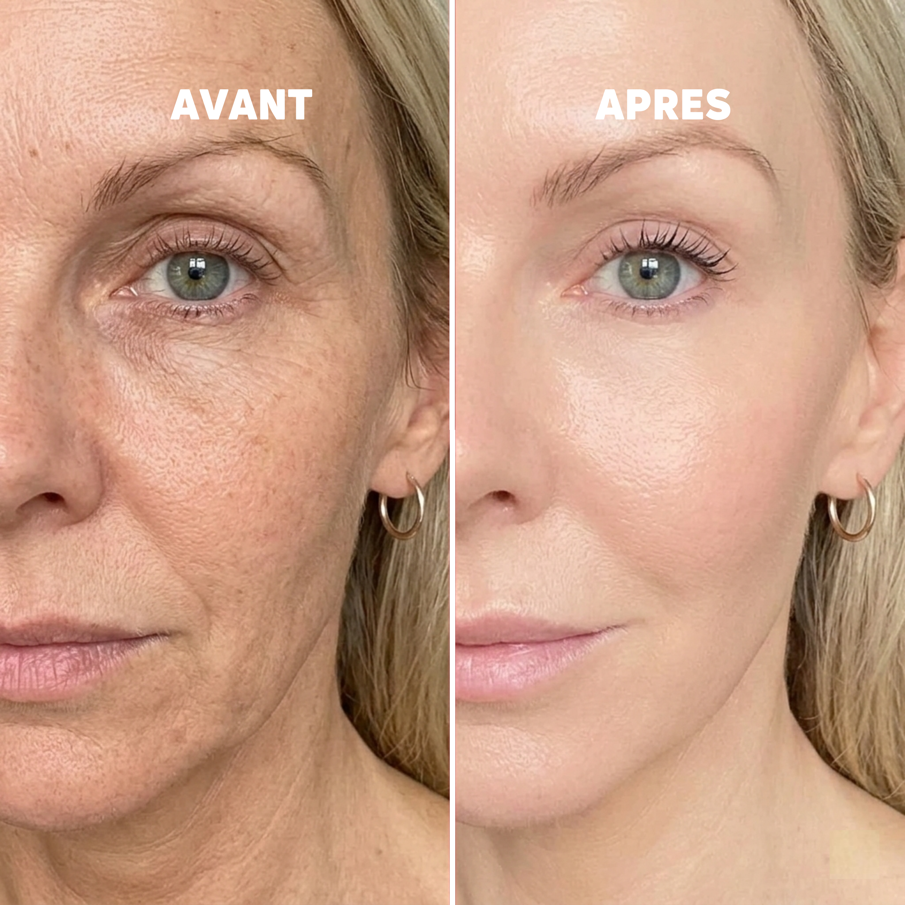 Baume au Calcium | Élu Meilleur Produit Beauté d'Europe