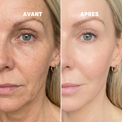 Baume au Calcium | Élu Meilleur Produit Beauté d'Europe