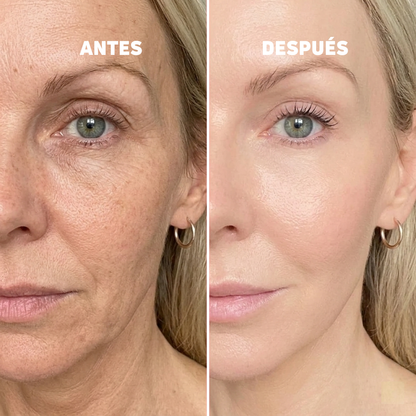 Baume au Calcium | Élu Meilleur Produit Beauté d'Europe