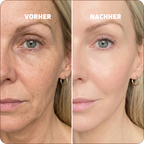 Baume au Calcium | Élu Meilleur Produit Beauté d'Europe