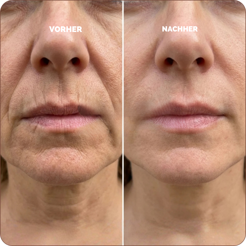 Baume au Calcium | Élu Meilleur Produit Beauté d'Europe