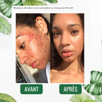 Stick Detox "Peau Nette" au Thé Vert | Élu Meilleur Produit Beauté d'Europe