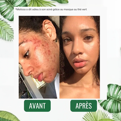 Stick Detox "Peau Nette" au Thé Vert | Élu Meilleur Produit Beauté d'Europe