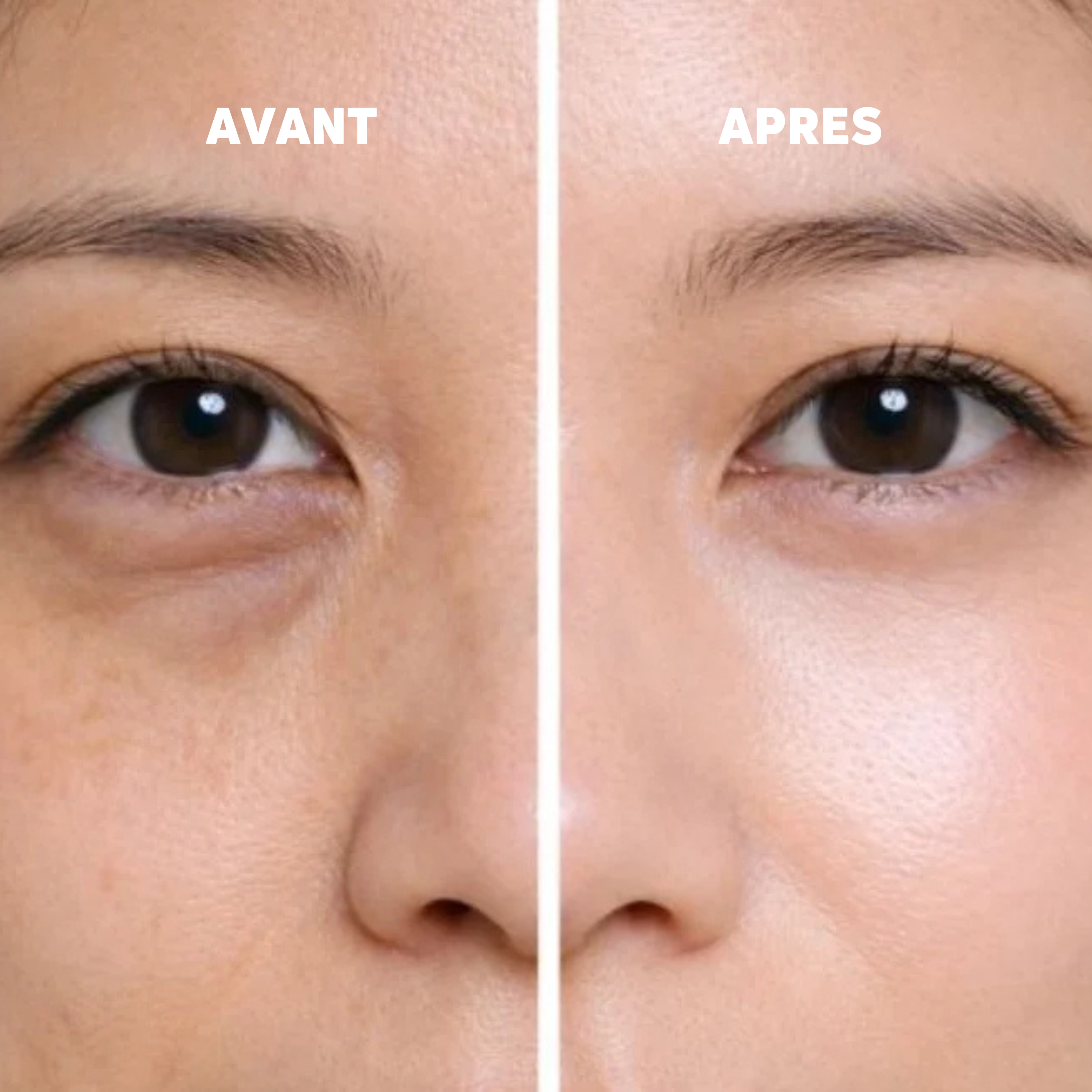 Baume au Calcium | Élu Meilleur Produit Beauté d'Europe