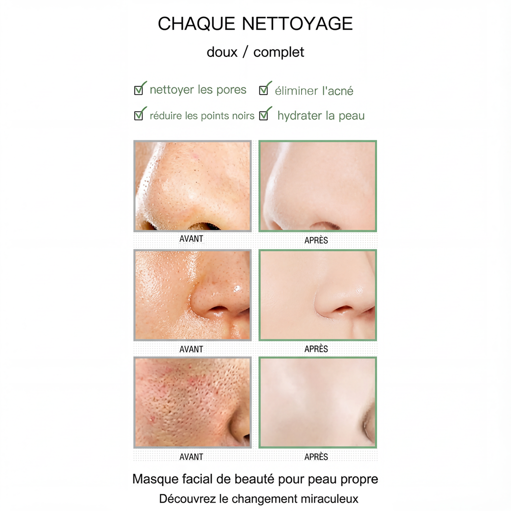 Stick Detox "Peau Nette" au Thé Vert | Élu Meilleur Produit Beauté d'Europe