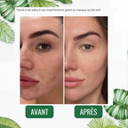 Stick Detox "Peau Nette" au Thé Vert | Élu Meilleur Produit Beauté d'Europe