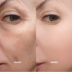 Ampoules Peel Shot au riz | Élu Meilleur Produit K-Beauty en Corée
