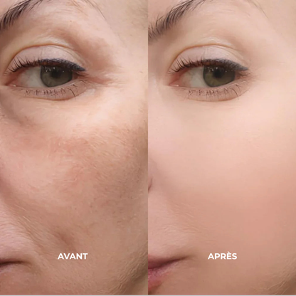 Ampoules Peel Shot au riz | Élu Meilleur Produit K-Beauty en Corée