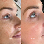 Ampoules Peel Shot au riz | Élu Meilleur Produit K-Beauty en Corée