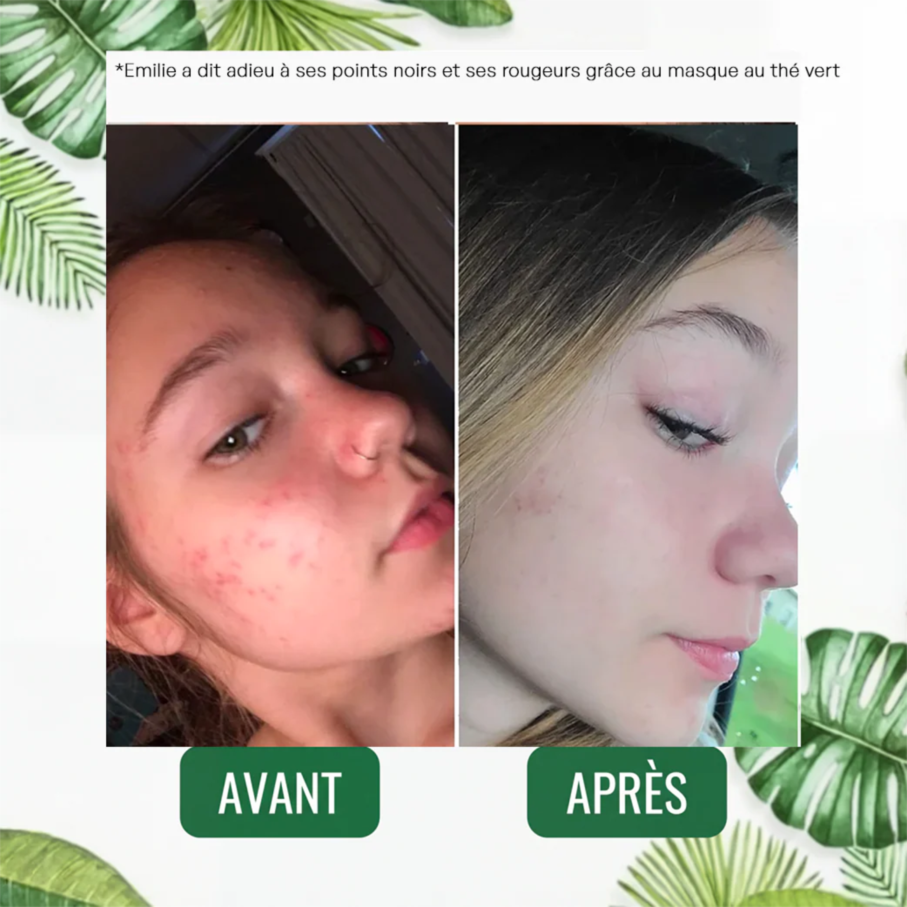 Stick Detox "Peau Nette" au Thé Vert | Élu Meilleur Produit Beauté d'Europe