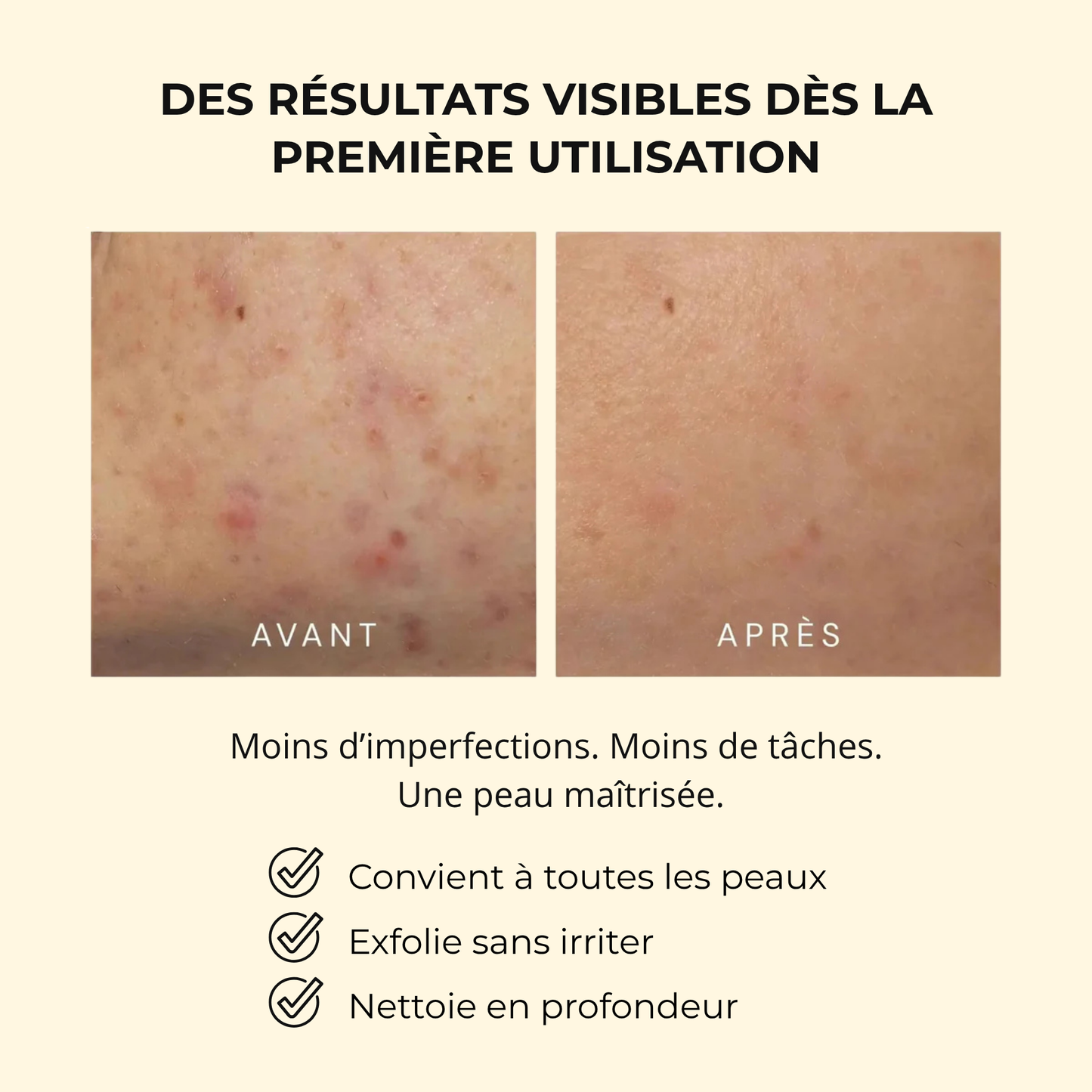 JOIA - Turmeric Bubble masque