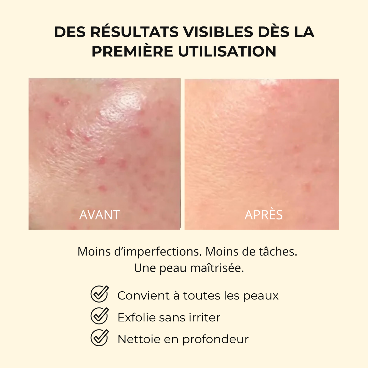 JOIA - Turmeric Bubble masque