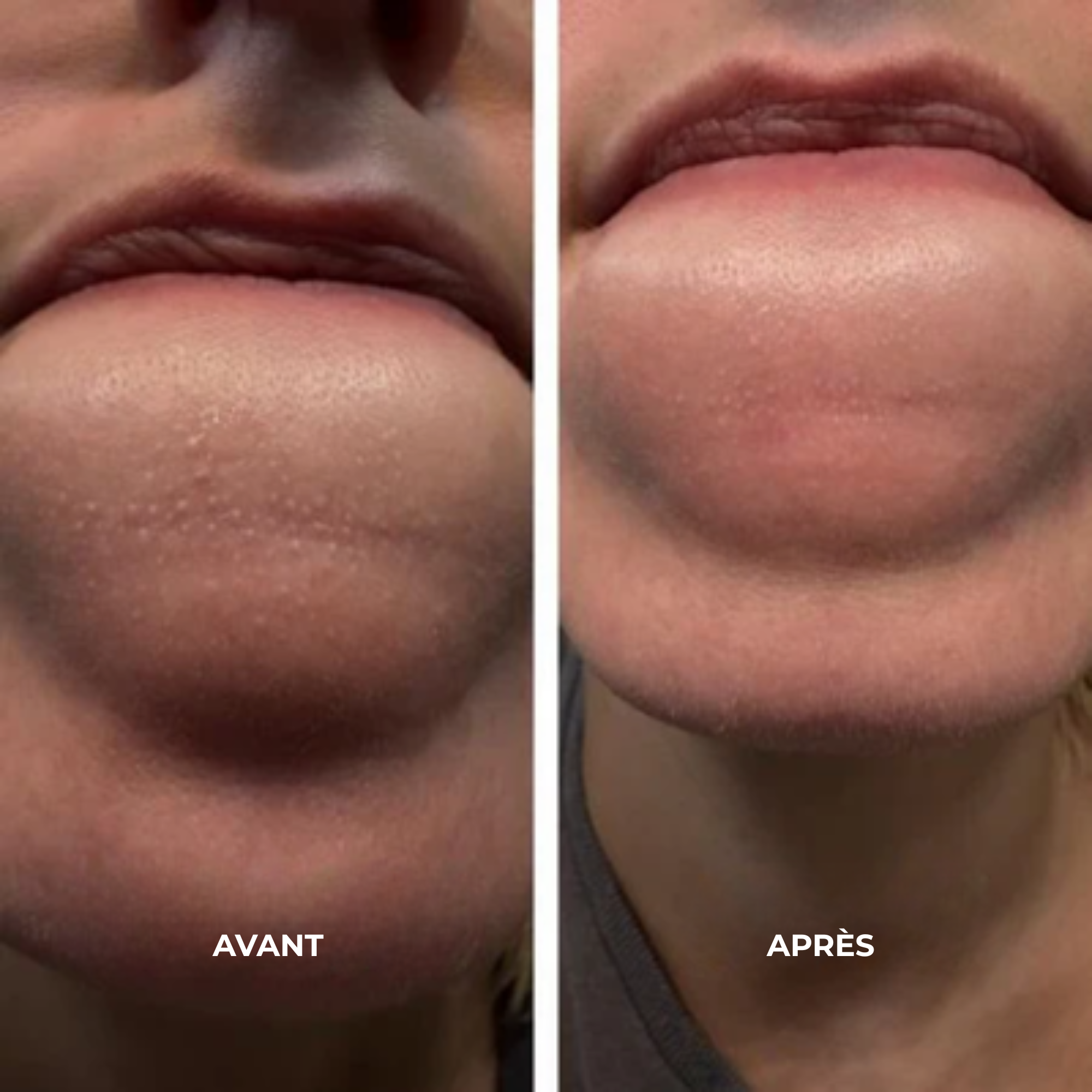 Ampoules Peel Shot au riz | Élu Meilleur Produit K-Beauty en Corée