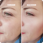 Baume au Calcium | Élu Meilleur Produit Beauté d'Europe