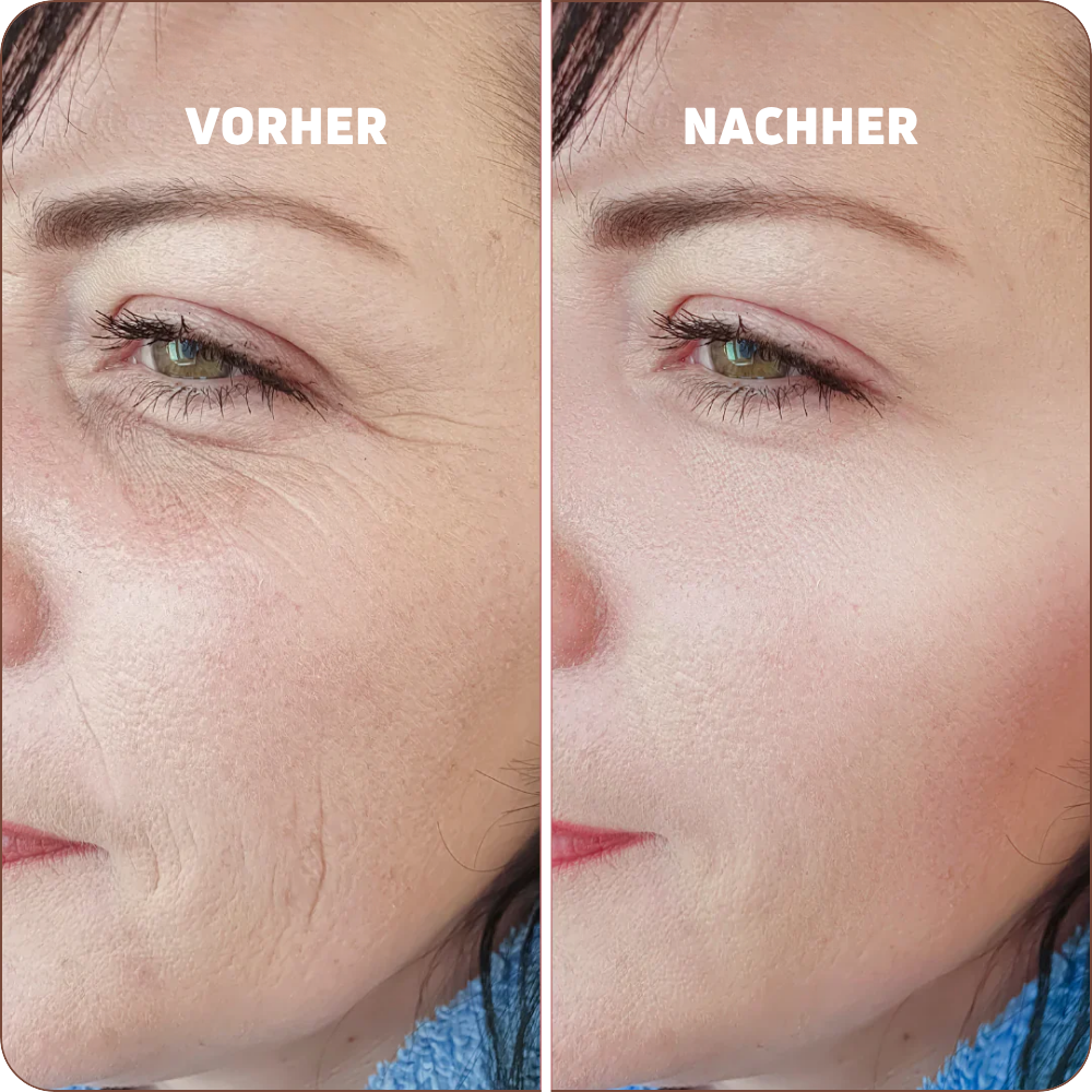 Baume au Calcium | Élu Meilleur Produit Beauté d'Europe