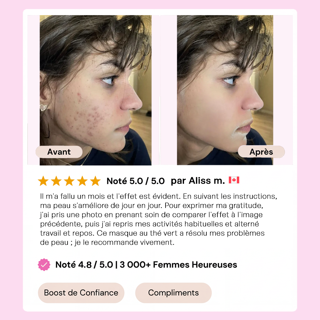 Stick Detox "Peau Nette" au Thé Vert | Élu Meilleur Produit Beauté d'Europe