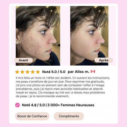 Stick Detox "Peau Nette" au Thé Vert | Élu Meilleur Produit Beauté d'Europe