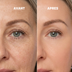 Baume au Calcium | Élu Meilleur Produit Beauté d'Europe