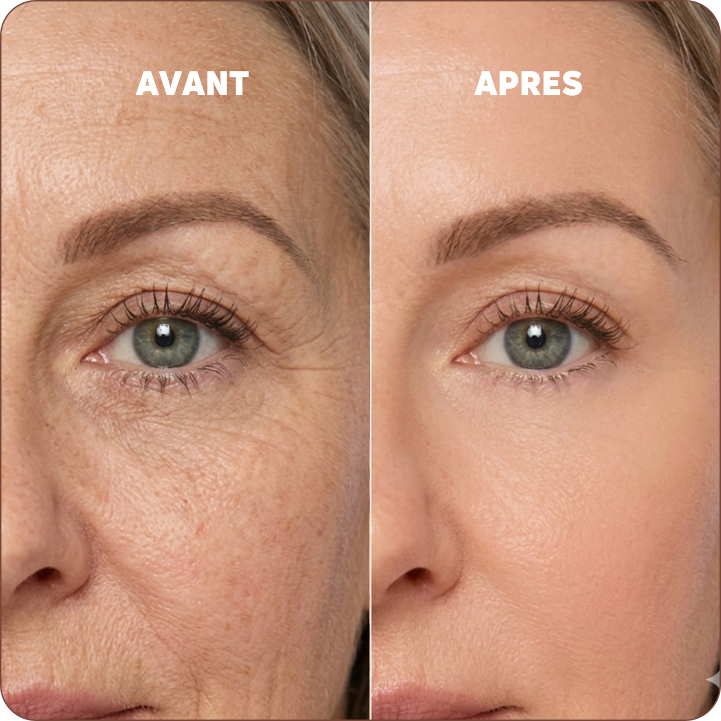 Baume au Calcium | Élu Meilleur Produit Beauté d'Europe