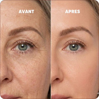 Baume au Calcium | Élu Meilleur Produit Beauté d'Europe