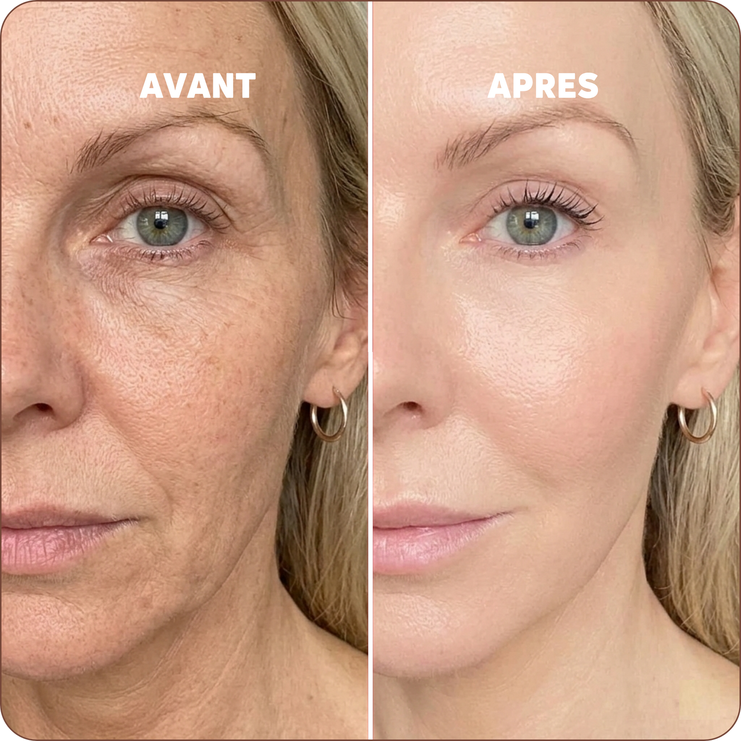 Baume au Calcium | Élu Meilleur Produit Beauté d'Europe