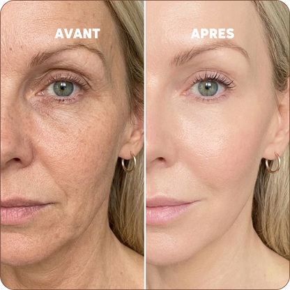 Baume au Calcium | Élu Meilleur Produit Beauté d'Europe