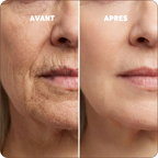 Baume au Calcium | Élu Meilleur Produit Beauté d'Europe
