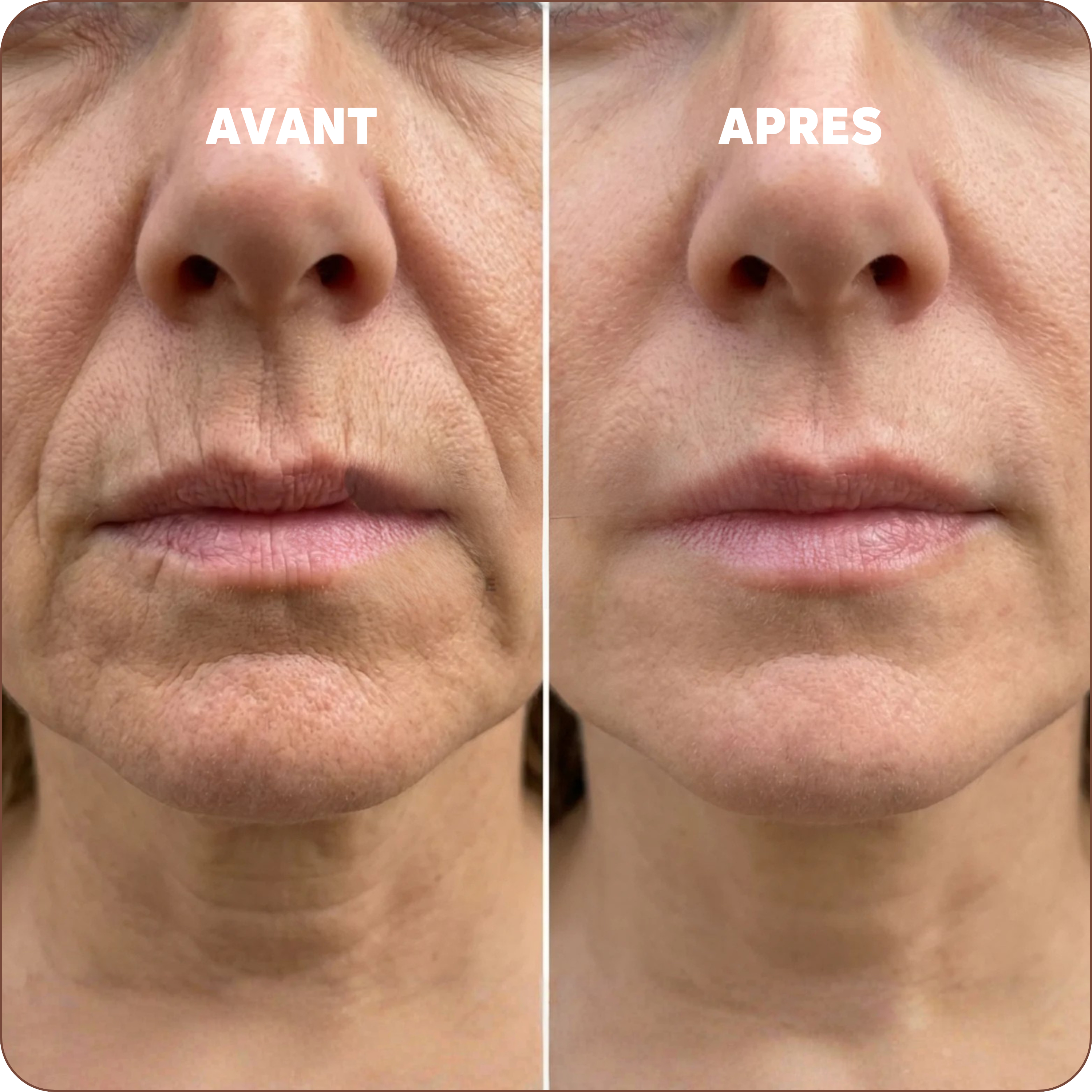 Baume au Calcium | Élu Meilleur Produit Beauté d'Europe