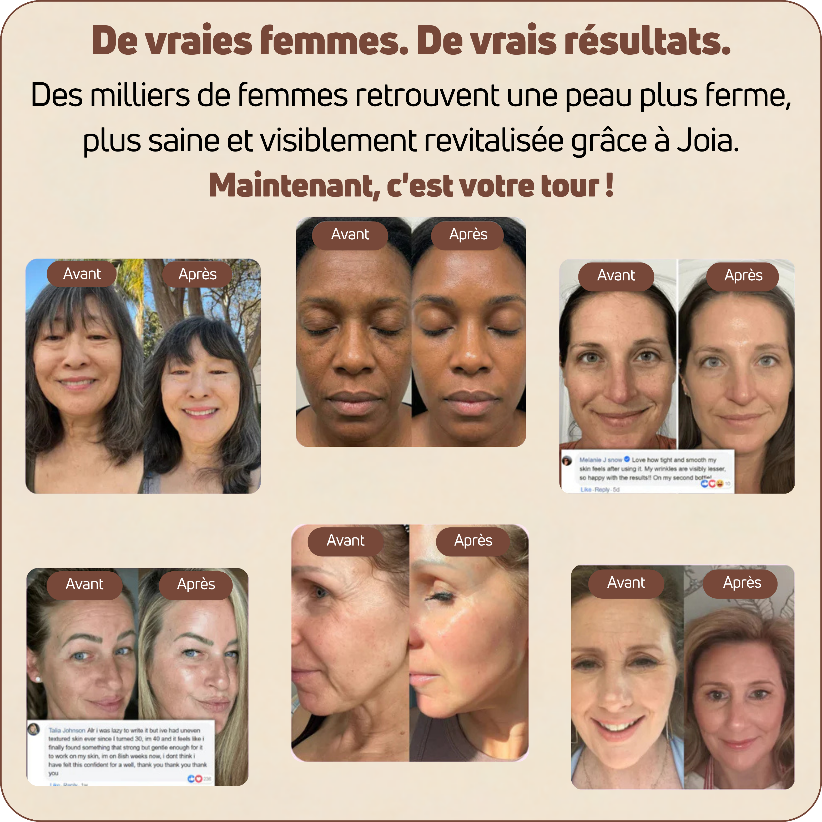 Baume au Calcium | Élu Meilleur Produit Beauté d'Europe
