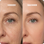 Baume au Calcium | Élu Meilleur Produit Beauté d'Europe