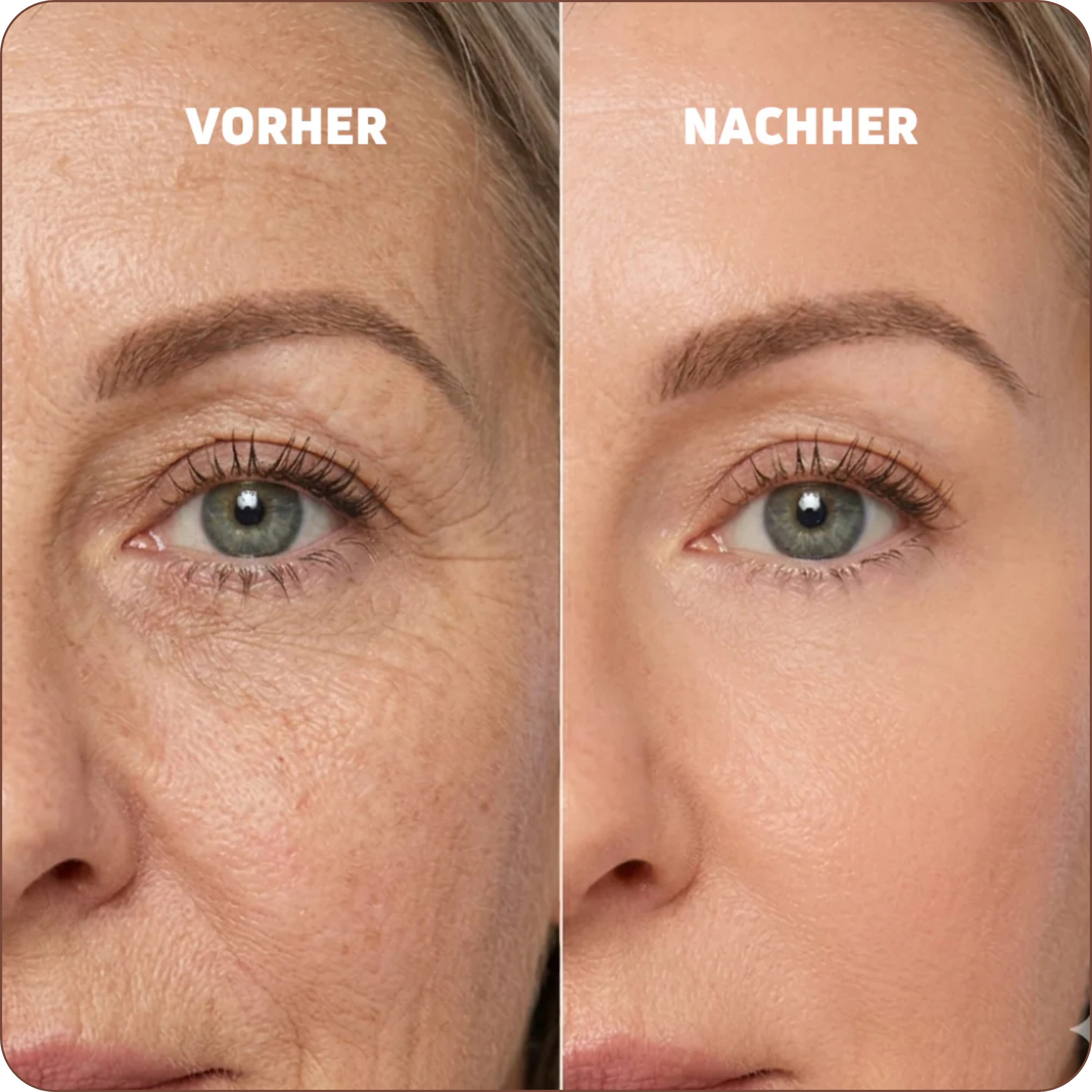 Baume au Calcium | Élu Meilleur Produit Beauté d'Europe