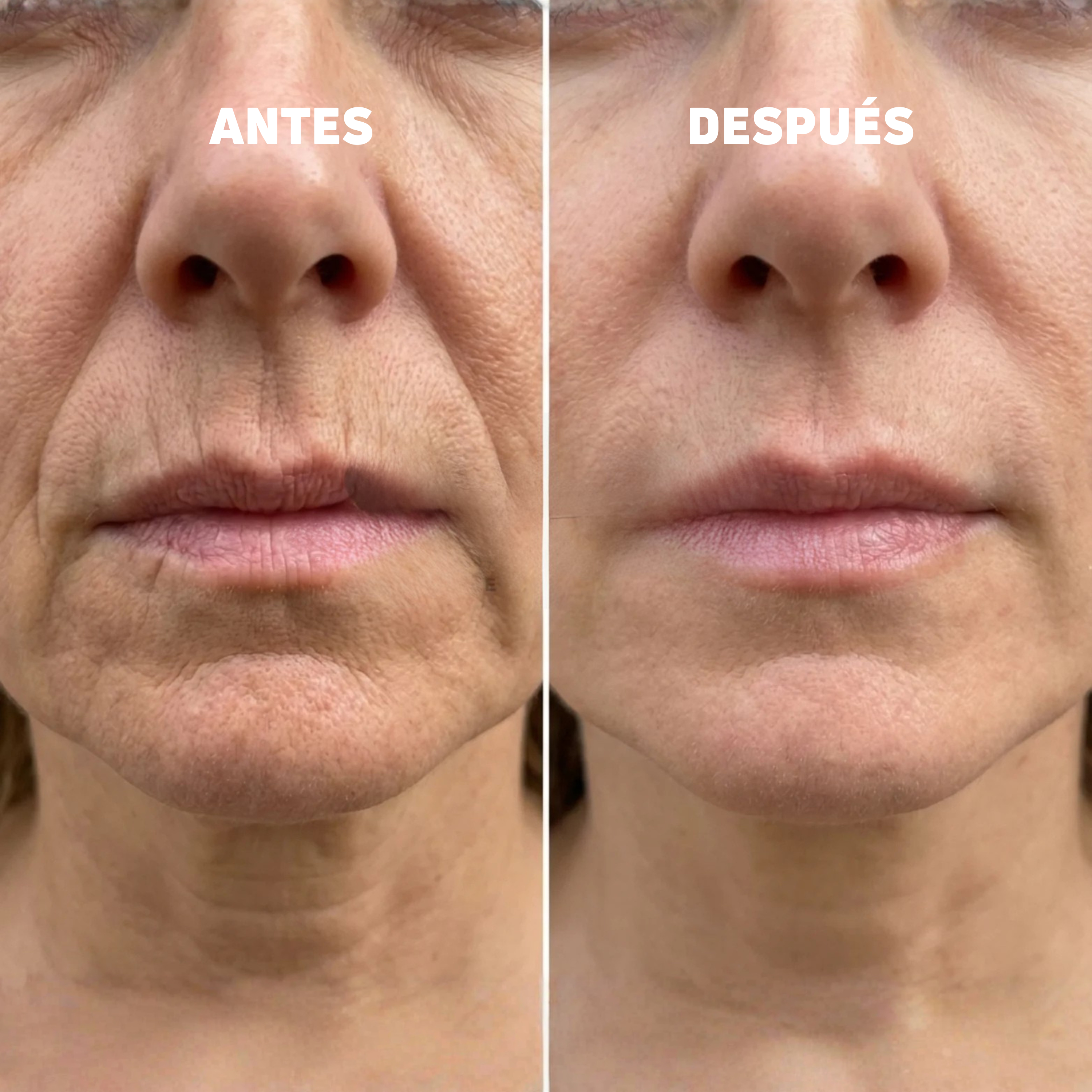Bálsamo coreano con efecto lifting | Elegido como Mejor Producto de Belleza