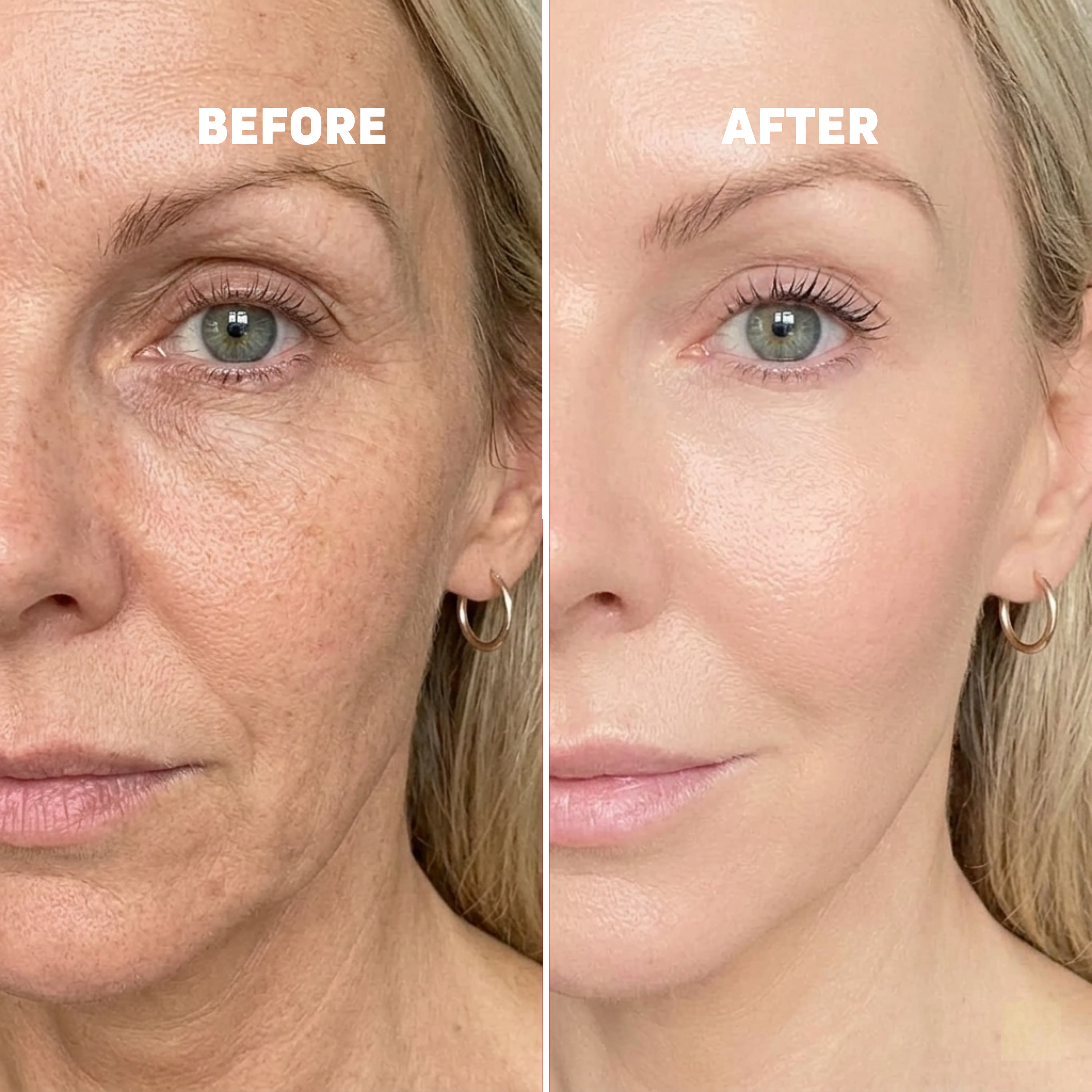 Calcium Multi Balm | Voted Best Beauty Product in New Zealand