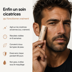 Stick réparateur de cicatrices d'acné clinique™