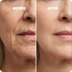 Calcium Multi Balm | Voted Best Beauty Product in Canada