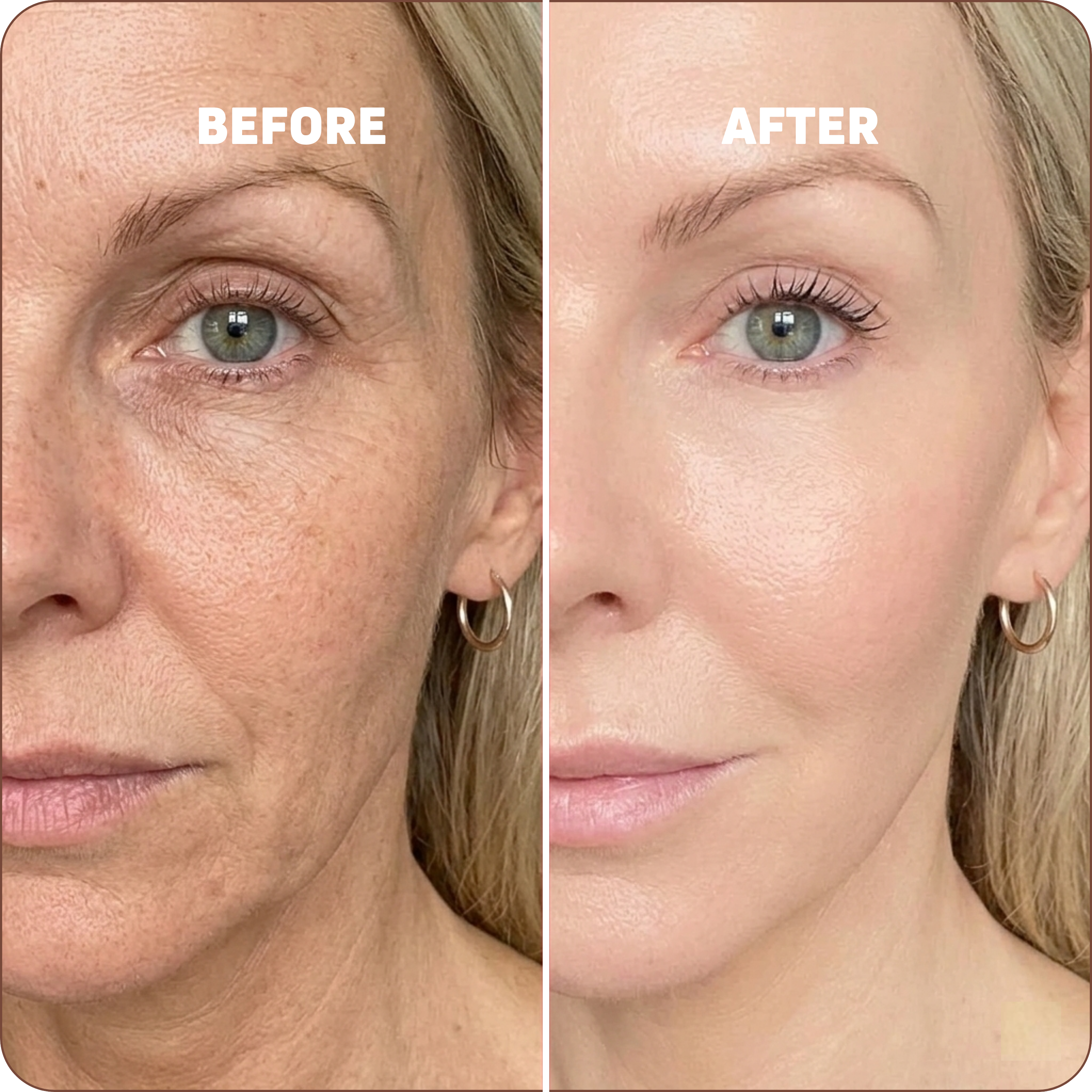 Calcium Multi Balm | Voted Best Beauty Product in Canada