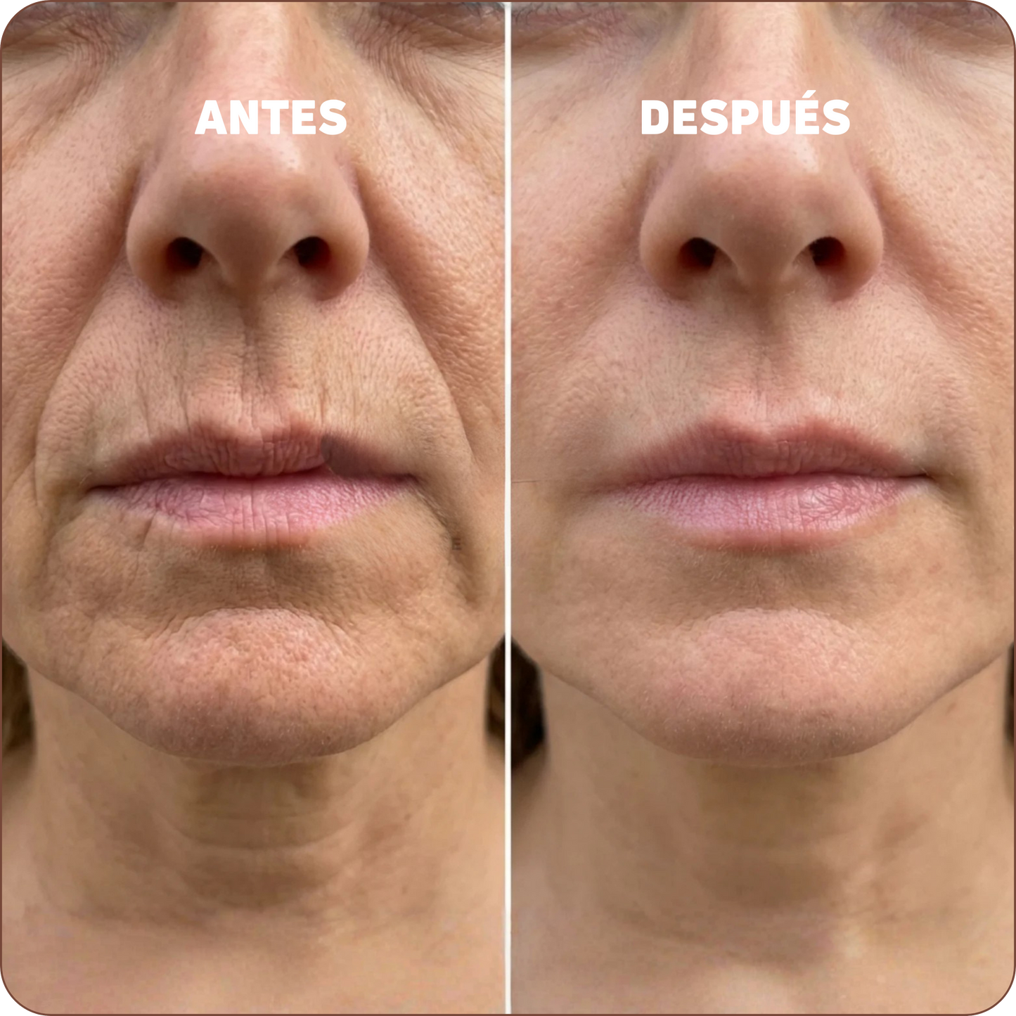 Bálsamo coreano con efecto lifting | Elegido como Mejor Producto de Belleza